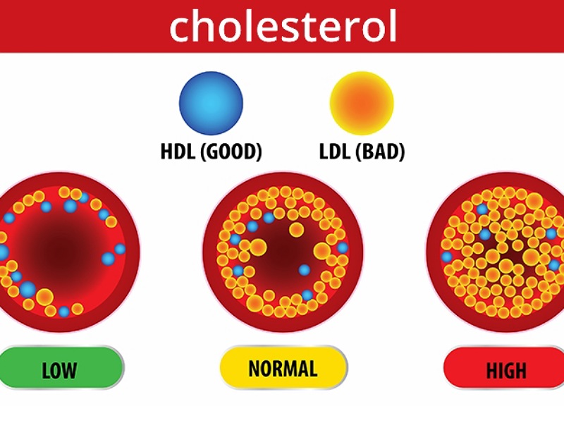 Different types of Cholesterol Different types of Cholesterol