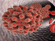 হেপাটাইটিছ “বি”