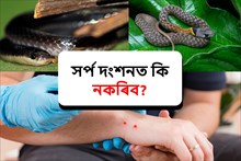 সৰ্প দংশনত কি নকৰিব?