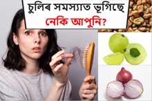 চুলিৰ সমস্যাত ভূগিছে নেকি আপুনি?  জানক প্ৰাকৃতিকভাৱে চুলিৰ সমস্যা সমাধানৰ উপায়?