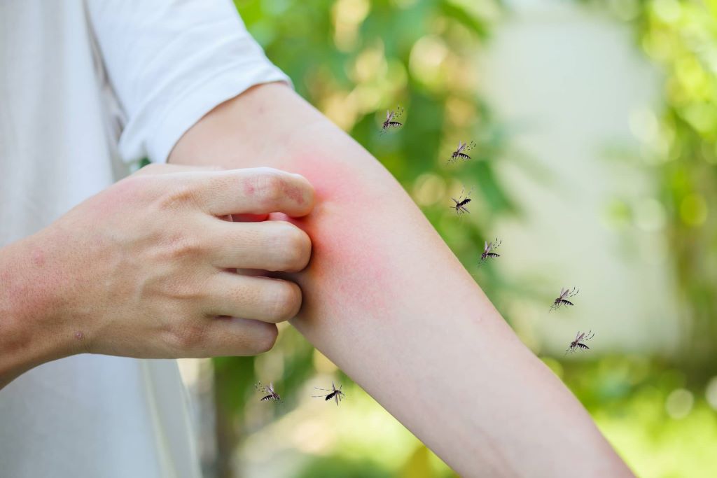 home remedies to get rid of mosquitoes in summer-