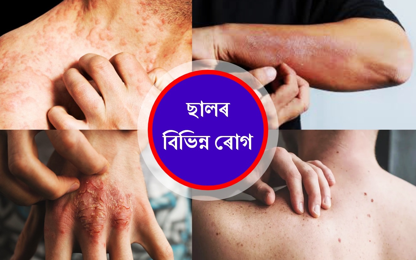 Skin Diseases and its Remedies in Ayurbed