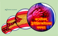 Ways to reduce cholesterol, triglyceridron problems-