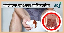 Piles: Symptoms, causes, and treatments