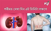 Kidney disease : আপোনাৰ কিডনি ৰোগগ্ৰস্ত হ’লে কেনেকৈ গম পাব! 
